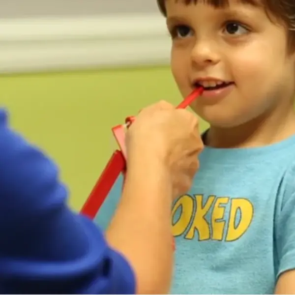 Evaluation for Therapy Planning: Lip Rounding and Tongue Mobility (Miles)